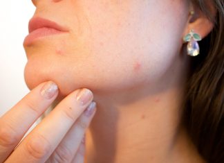 Nonacne – Lek na Trądzik – Opinie, recenzje, oferty – Gdzie kupić ? Nonacne