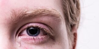 Co zrobić z siniakami pole dance? Co zrobić z siniakami pole dance?